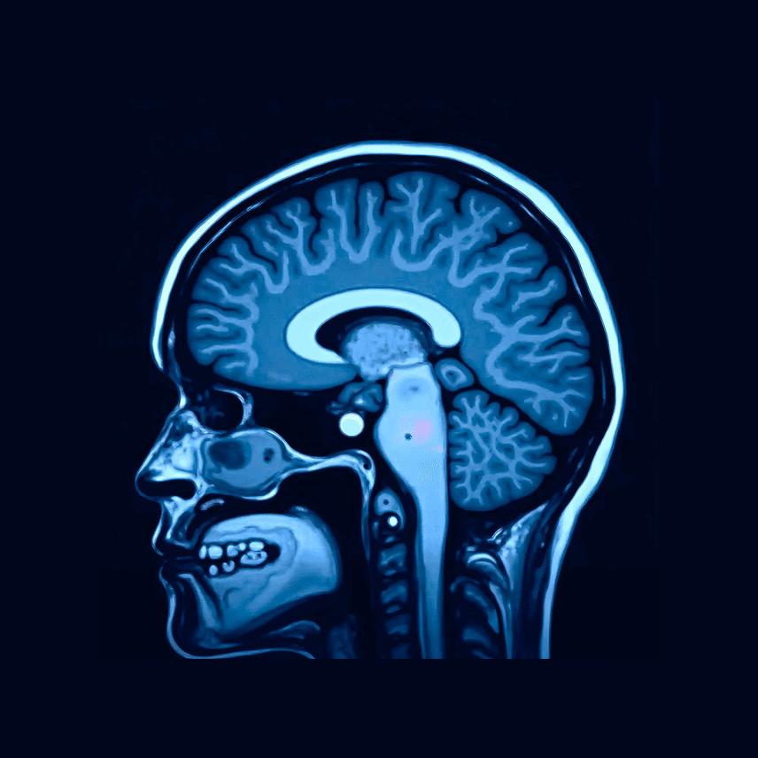 mri-shape